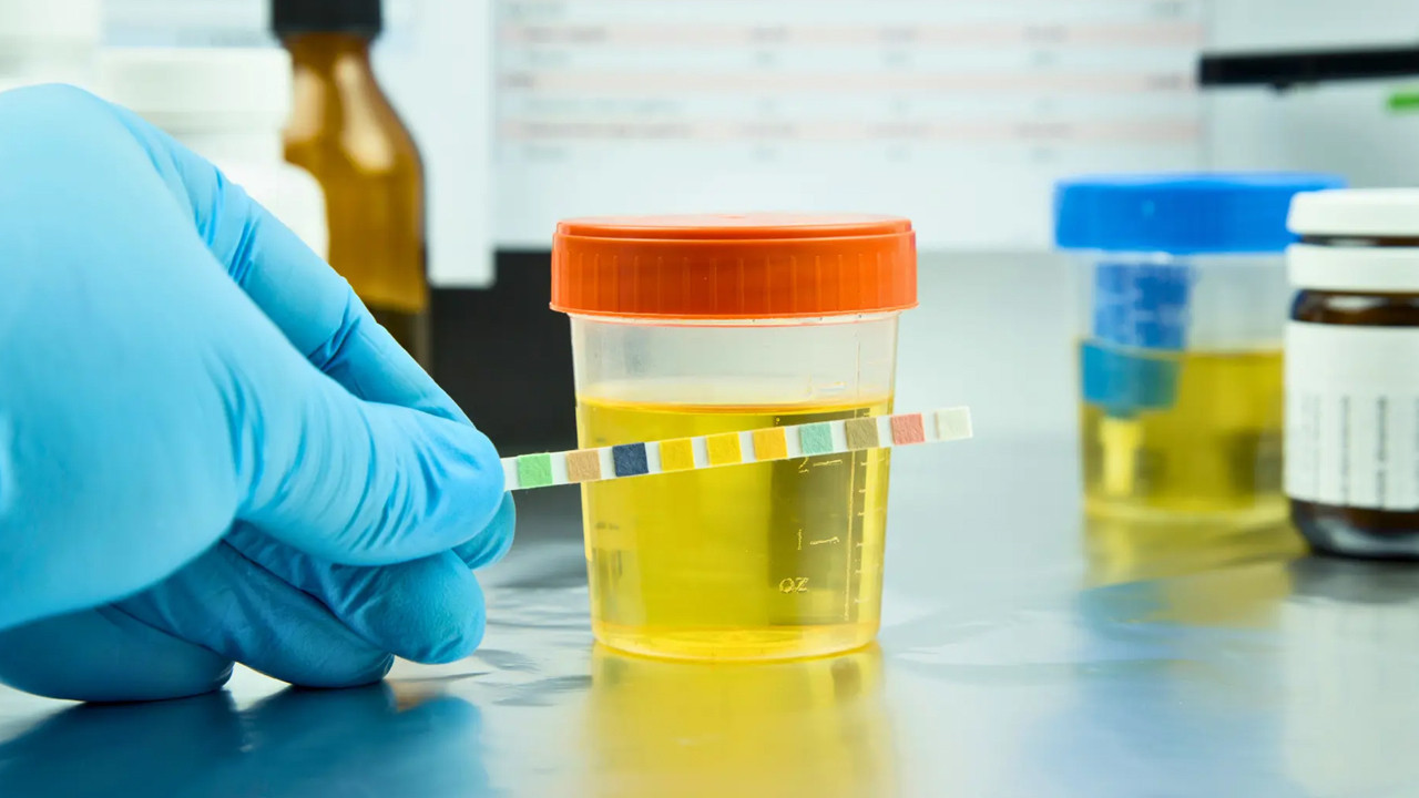 İstanbul’daki Uyuşturucu Soruşturmasında 4 Kişinin Test Sonucu Belli Oldu