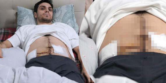 İstanbul’un Göbeğinde Dehşet! Saldırıya Uğrayan Çocuğa Yardım Etmek İstedi, 6 Yerinden Bıçaklandı