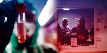 Sessiz İlerliyor, Kalp ve Böbreği Çökertiyor: Çok Hızlı Yayılıp Anında Öldürüyor