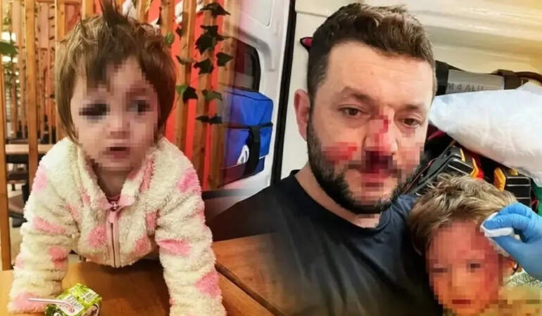 Baba ve 14 Aylık Bebeğin Darbedildiği Olayda Tutuklu Komşunun Kan Donduran İfadesi: ‘Çocuğu Fark Etmedim’