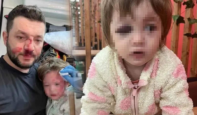 Yalova’daki Scooterlı Vahşete Jet İddianame! İşte Baba ve Kızına Saldıran Şüpheli İçin İstenen Ceza…