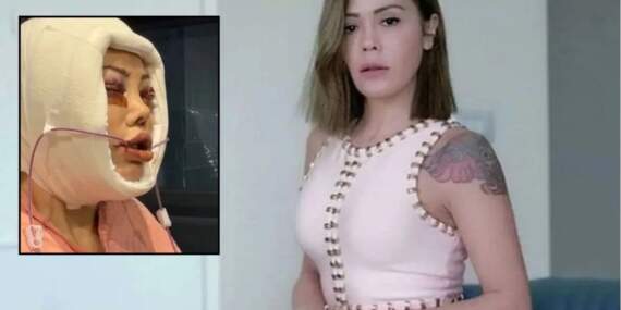 Yüz nakli operasyonları gündem olmuştu: Didem Ceran’dan kötü haber!
