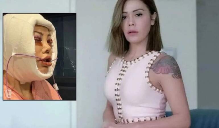Yüz nakli operasyonları gündem olmuştu: Didem Ceran’dan kötü haber!