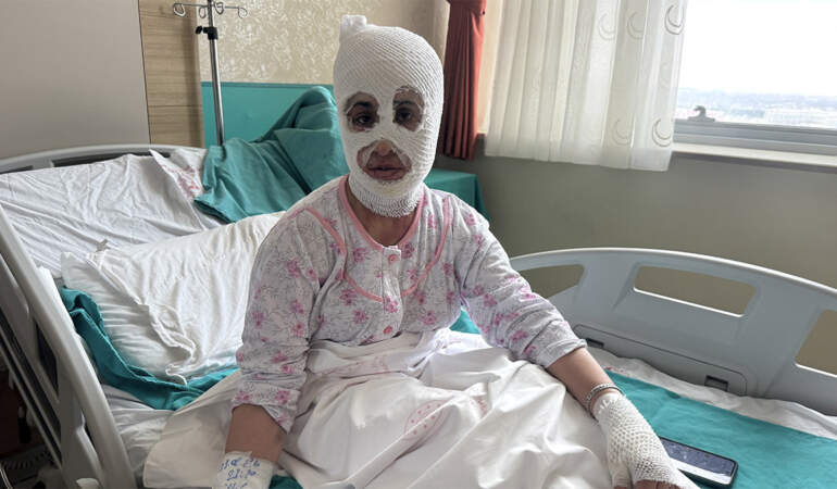 İftar hazırlığında düdüklü tencere patladı! Genç kadın ağır yaralandı: ‘Ben yandım başkası yanmasın’
