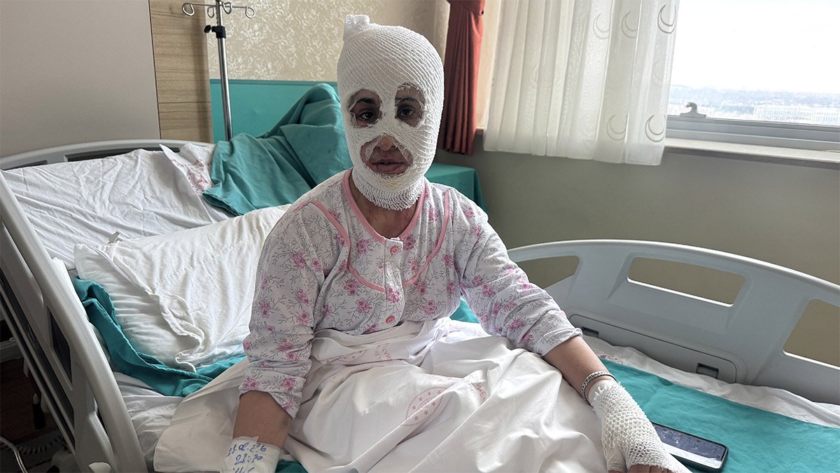 İftar hazırlığında düdüklü tencere patladı! Genç kadın ağır yaralandı: ‘Ben yandım başkası yanmasın’