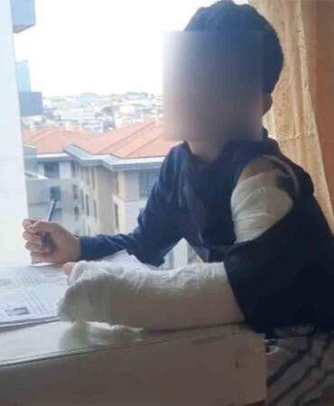 Ümraniye’de akran zorbalığı: Sınıf arkadaşı çelme taktı, 7 yaşındaki çocuğun kolu kırıldı