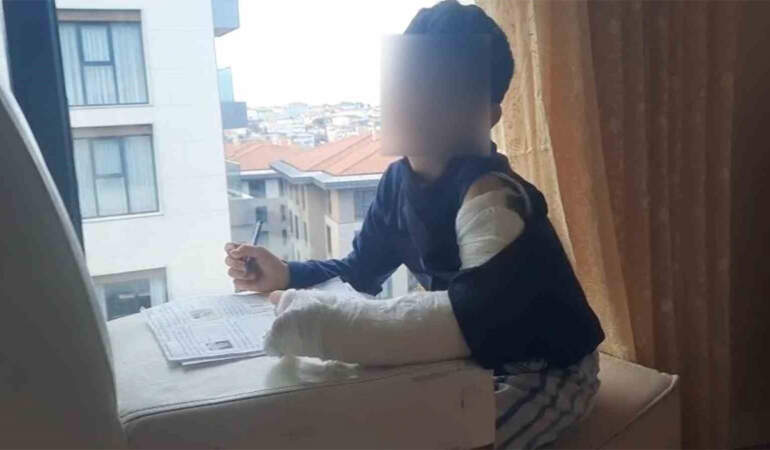 Ümraniye’de akran zorbalığı: Sınıf arkadaşı çelme taktı, 7 yaşındaki çocuğun kolu kırıldı