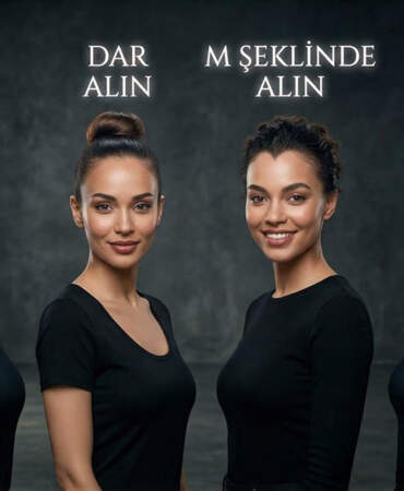 Yüz okuma nasıl yapılır? Alın yapısı ne anlama gelir? Alın yapısından karakter analizi nasıl yapılır? Uzmanından alın çizgisi analizi