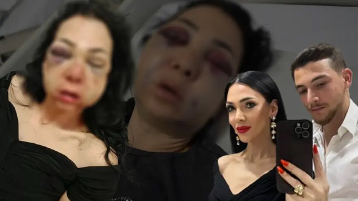 Kocaeli’de infial yaratan olay: Oğlunun gözü önünde anneyi öldüresiye dövdüler