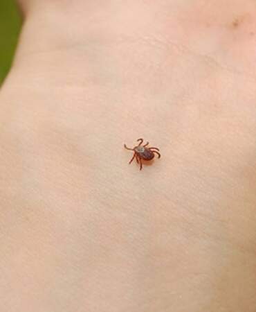 Yağışlar arttı uyarılar peş peşe geldi! ‘Vakalar bir anda artabilir’ Yaz boyu dikkatli olun