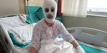 İftar Vakti ‘Düdüklü Tencere’ Faciası: Bomba Gibi Patladı! ‘Yüzüme Dokunduğumda Et Parçası Geliyordu’