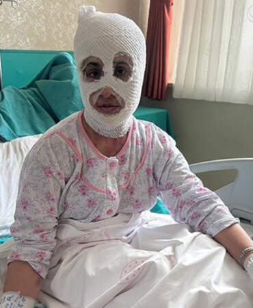 İftar Vakti ‘Düdüklü Tencere’ Faciası: Bomba Gibi Patladı! ‘Yüzüme Dokunduğumda Et Parçası Geliyordu’