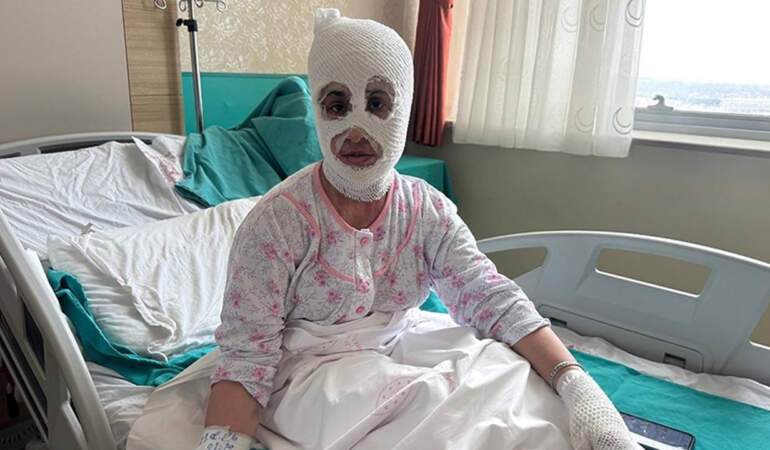 İftar Vakti ‘Düdüklü Tencere’ Faciası: Bomba Gibi Patladı! ‘Yüzüme Dokunduğumda Et Parçası Geliyordu’