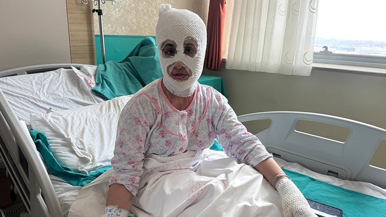 İftar Vakti ‘Düdüklü Tencere’ Faciası: Bomba Gibi Patladı! ‘Yüzüme Dokunduğumda Et Parçası Geliyordu’