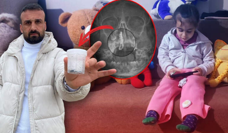 Rize’de Akılalmaz Olay: Küçük Polen’in Burnundan Çıkana Kimse İnanamadı