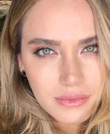 Ceyda Ateş zayıflık takıntısıyla şoke etti! Doktoru bile inanamadı: ‘Kemiklerim kuma batıyordu’