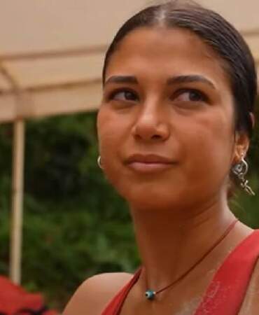 Survivor Gizem’den sağlık açıklaması! ‘2 oldu ama hala düzelmedi’