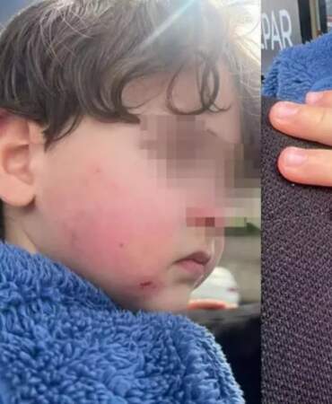 Kreşte 2,5 yaşındaki çocuğa darp: Kurumun ‘2 dakika’ savunması pes dedirtti