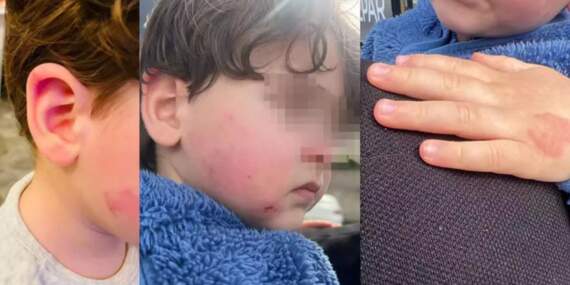 Kreşte 2,5 yaşındaki çocuğa darp: Kurumun ‘2 dakika’ savunması pes dedirtti