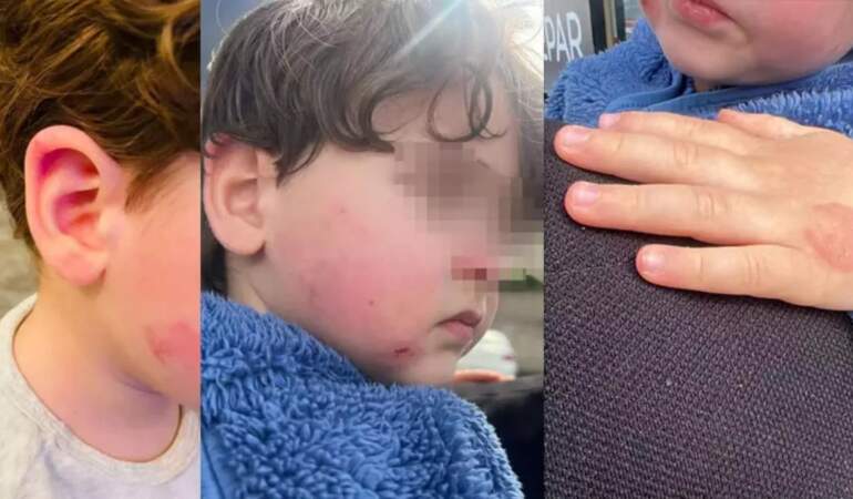 Kreşte 2,5 yaşındaki çocuğa darp: Kurumun ‘2 dakika’ savunması pes dedirtti