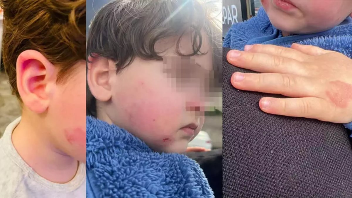 Kreşte 2,5 yaşındaki çocuğa darp: Kurumun ‘2 dakika’ savunması pes dedirtti