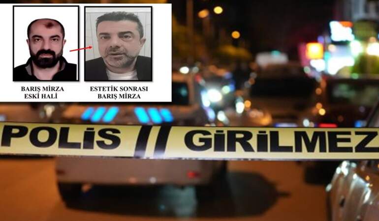 Ankara’da film gibi olay: Ameliyatla yüzünü değiştiren cinayet zanlısı 7 yıl sonra yakalandı