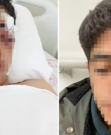 15 yaşındaki çocuğa akranından muştalı saldırı: Vücudunda çok sayıda kırık var
