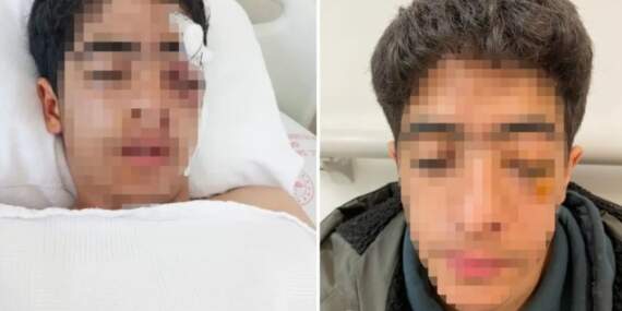 15 yaşındaki çocuğa akranından muştalı saldırı: Vücudunda çok sayıda kırık var