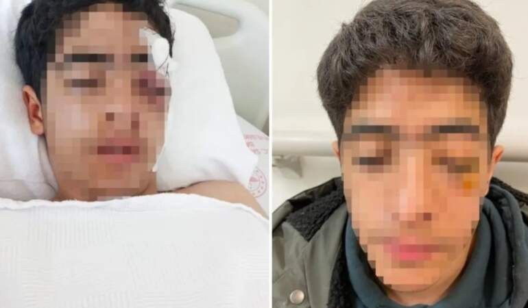 15 yaşındaki çocuğa akranından muştalı saldırı: Vücudunda çok sayıda kırık var