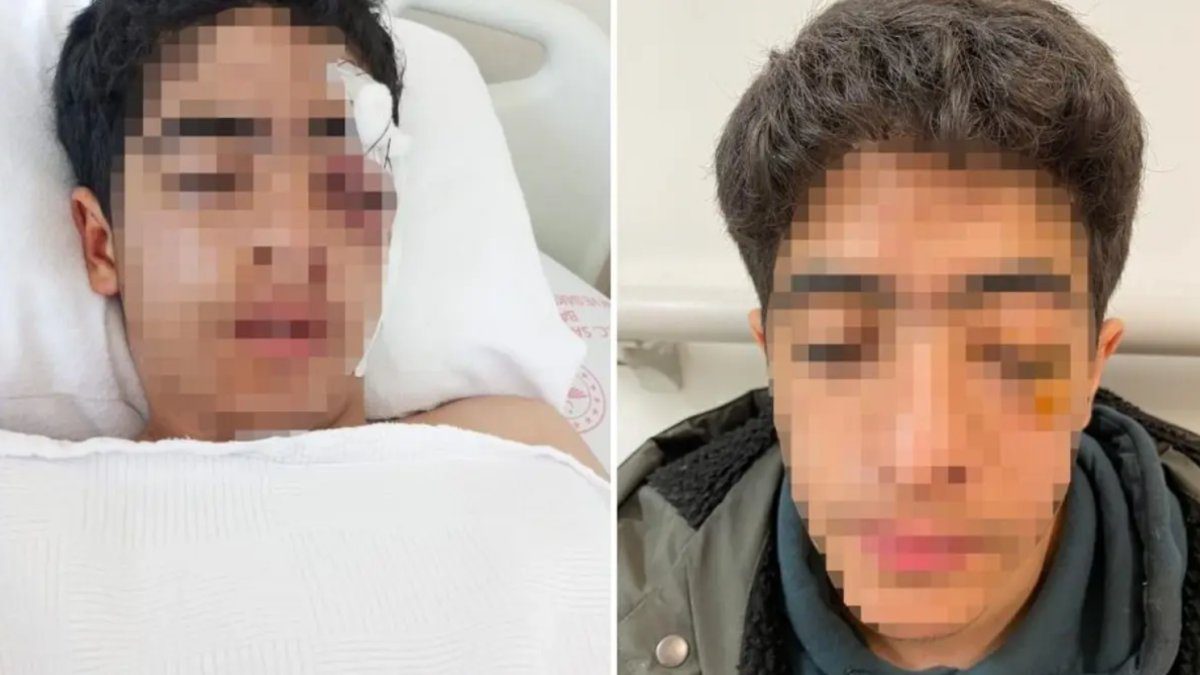 15 yaşındaki çocuğa akranından muştalı saldırı: Vücudunda çok sayıda kırık var