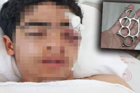 Akran zorbalığı yine can yaktı: 15 yaşındaki çocuk muştayla öldüresiye dövüldü