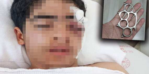 Akran zorbalığı yine can yaktı: 15 yaşındaki çocuk muştayla öldüresiye dövüldü
