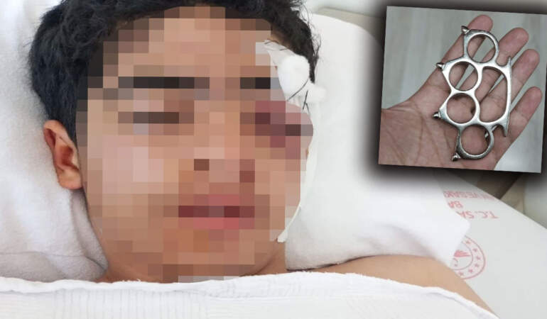Akran zorbalığı yine can yaktı: 15 yaşındaki çocuk muştayla öldüresiye dövüldü