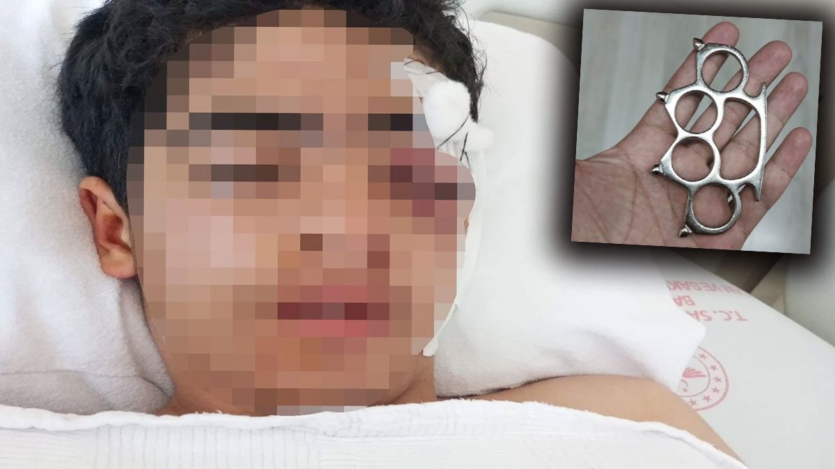 Akran zorbalığı yine can yaktı: 15 yaşındaki çocuk muştayla öldüresiye dövüldü