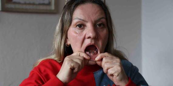 Diş tedavisi kabusa döndü! 25 dişi birden çekildi, ‘ağrıların psikolojik’ denildi