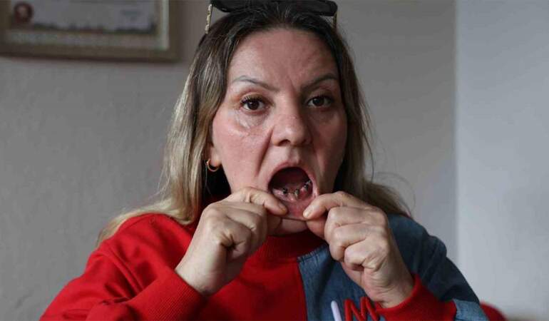 Diş tedavisi kabusa döndü! 25 dişi birden çekildi, ‘ağrıların psikolojik’ denildi