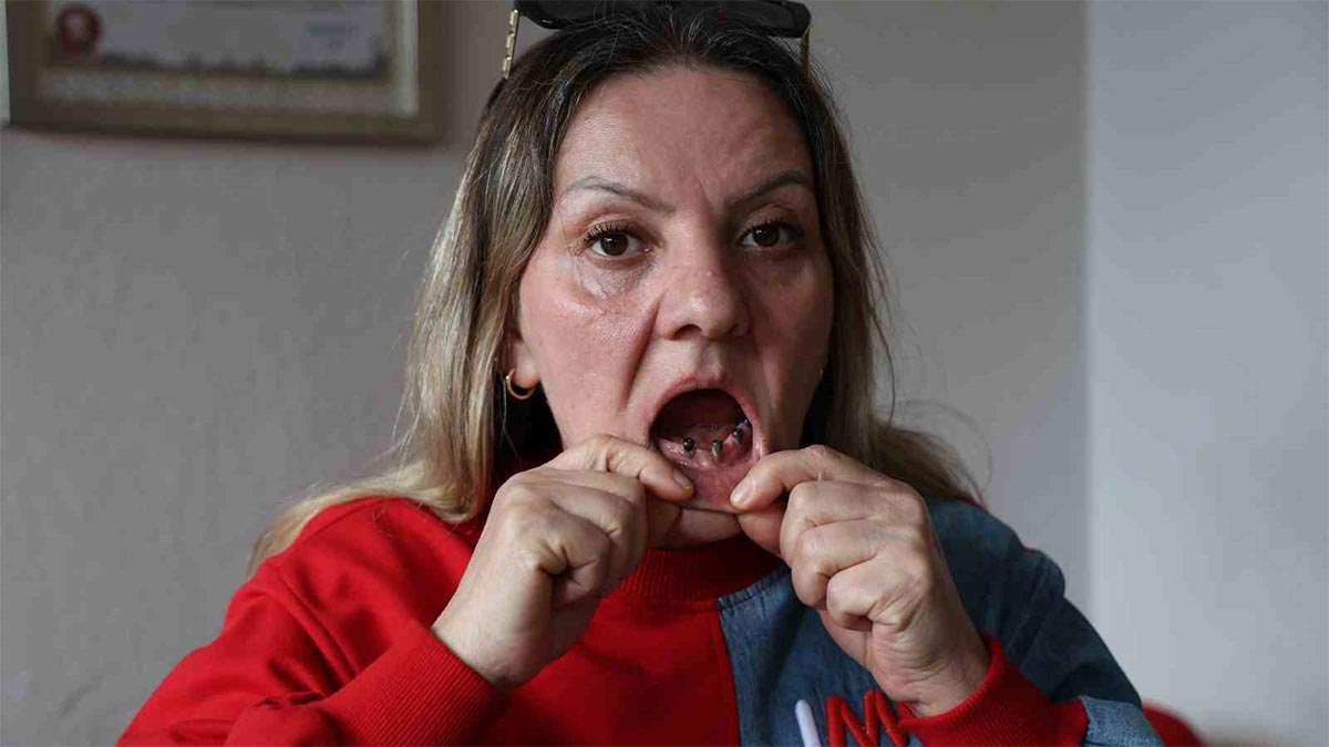 Diş tedavisi kabusa döndü! 25 dişi birden çekildi, ‘ağrıların psikolojik’ denildi