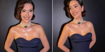 4 ayda 20 kilo birden gitti! Bergüzar Korel’in ‘midemi aldırdım’ sözleri şaşkınlık yarattı: Gerçek bambaşka çıktı