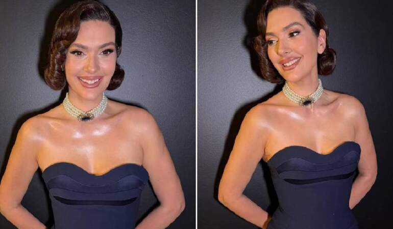 4 ayda 20 kilo birden gitti! Bergüzar Korel’in ‘midemi aldırdım’ sözleri şaşkınlık yarattı: Gerçek bambaşka çıktı