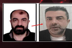 Filmleri Aratmayan Olay! 7 Yıldır Firariydi… Estetik de Kurtarmadı