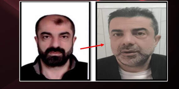 Filmleri Aratmayan Olay! 7 Yıldır Firariydi… Estetik de Kurtarmadı