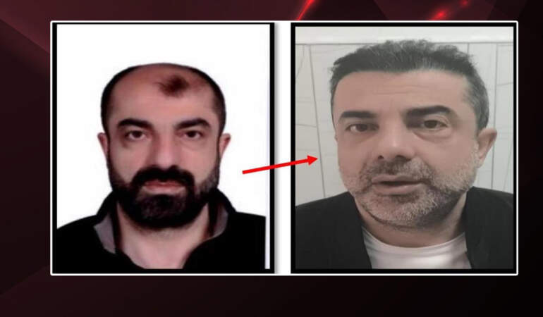 Filmleri Aratmayan Olay! 7 Yıldır Firariydi… Estetik de Kurtarmadı