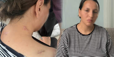 Korumayan Bir Uzaklaştırma Daha… Havva 17 Bıçak Darbesinden ‘Ölü Numarası’ ile Kurtuldu