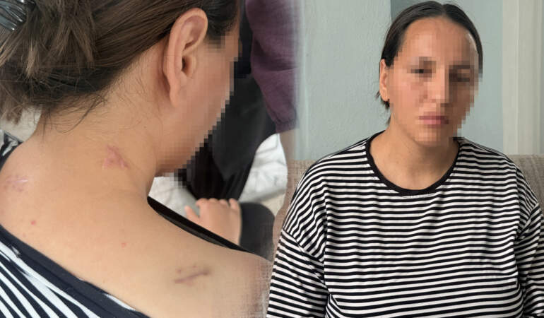 Korumayan Bir Uzaklaştırma Daha… Havva 17 Bıçak Darbesinden ‘Ölü Numarası’ ile Kurtuldu