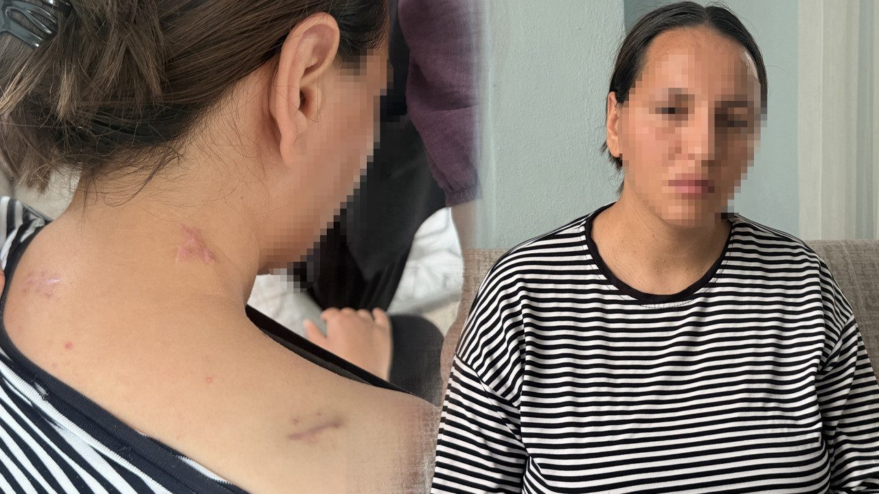 Korumayan Bir Uzaklaştırma Daha… Havva 17 Bıçak Darbesinden ‘Ölü Numarası’ ile Kurtuldu