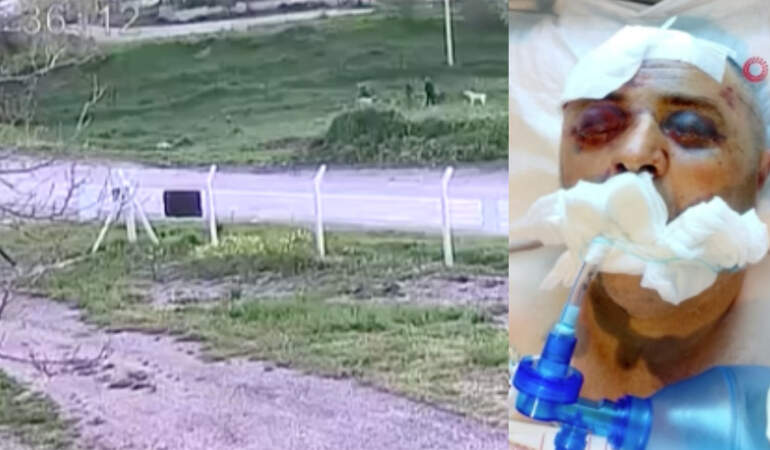 Ankara’da köpek kavgası kanlı bitti! Komşusunu demir çubukla darp etti