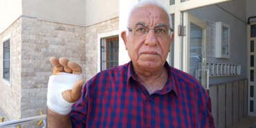 Hatay’da akılalmaz olay! ‘Onu çok severdim’ dediği komşusu parmağını ısırarak kopardı