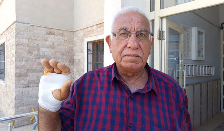 Hatay’da akılalmaz olay! ‘Onu çok severdim’ dediği komşusu parmağını ısırarak kopardı