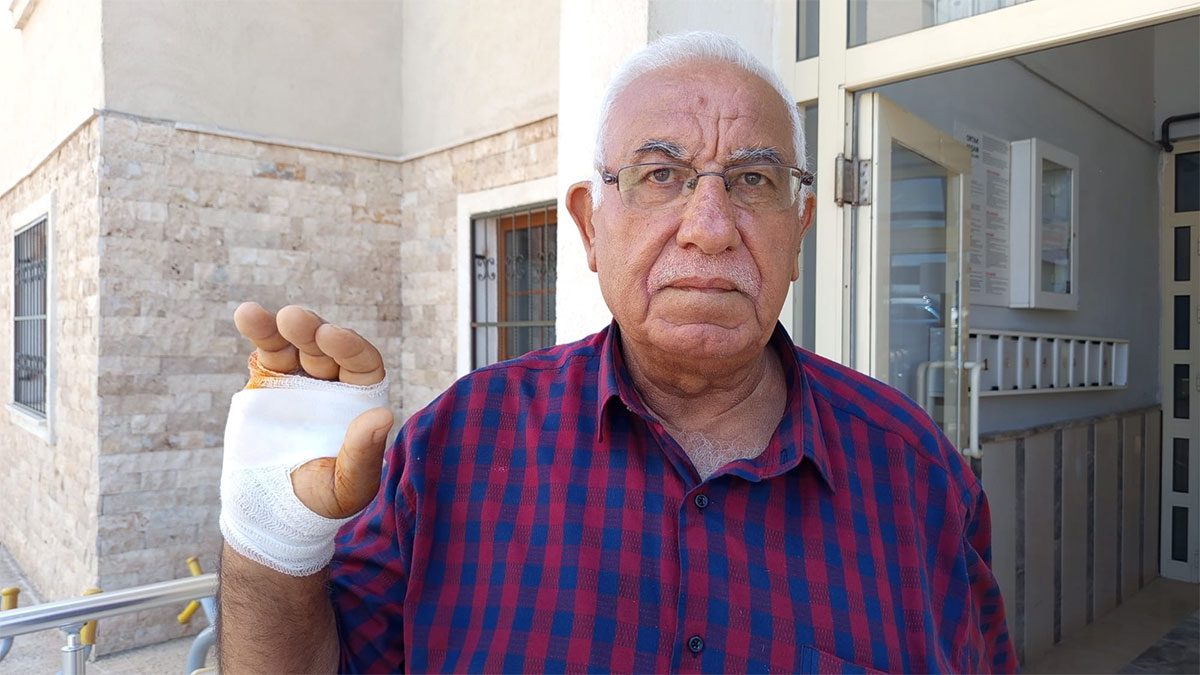 Hatay’da akılalmaz olay! ‘Onu çok severdim’ dediği komşusu parmağını ısırarak kopardı
