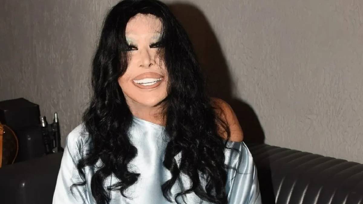 Bülent Ersoy estetik yaptırdı! 74 yaşında ‘Yüzümü Lolita gibi yaptırdım’ dedi